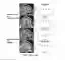 Fig. 20 - Systems and methods for generating biomarkers based on multivariate classification of functional imaging and associated data
