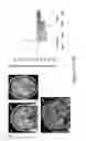 Fig. 23 - Systems and methods for generating biomarkers based on multivariate classification of functional imaging and associated data