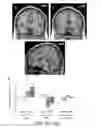 Fig. 24 - Systems and methods for generating biomarkers based on multivariate classification of functional imaging and associated data