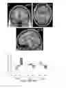 Fig. 25 - Systems and methods for generating biomarkers based on multivariate classification of functional imaging and associated data