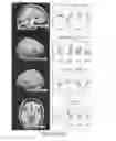 Fig. 26 - Systems and methods for generating biomarkers based on multivariate classification of functional imaging and associated data