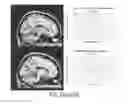 Fig. 28 - Systems and methods for generating biomarkers based on multivariate classification of functional imaging and associated data