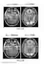 Fig. 29 - Systems and methods for generating biomarkers based on multivariate classification of functional imaging and associated data