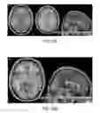 Fig. 30 - Systems and methods for generating biomarkers based on multivariate classification of functional imaging and associated data