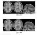 Fig. 31 - Systems and methods for generating biomarkers based on multivariate classification of functional imaging and associated data