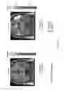 Fig. 34 - Systems and methods for generating biomarkers based on multivariate classification of functional imaging and associated data