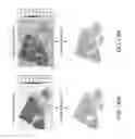 Fig. 22 - Whole slide image registration and cross-image annotation devices, systems and methods