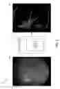 Fig. 02 - Edge detection in images