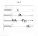 Fig. 07 - Method for controlling speech-recognition text-generation system and method for controlling mobile terminal