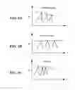 Fig. 08 - Methods and apparatus for dynamic low frequency noise suppression
