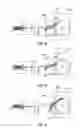 Fig. 09 - Method for making amorphous metal transformer cores