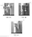 Fig. 05 - TEM sample preparation