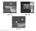 Fig. 08 - TEM sample preparation