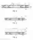 Fig. 03 - Semiconductor package and method of manufacturing the same