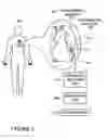 Fig. 06 - Energy harvesting with two conducting antenna within different substances