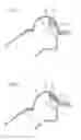 Fig. 03 - Speaker