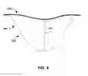 Fig. 08 - Ultrasonic transducer