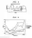 Fig. 03 - Tinnitus rehabilitation device and method