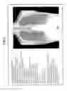 Fig. 10 - Exposure management system