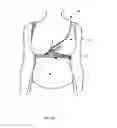 Fig. 08 - Crossover Maternity and Nursing Garment