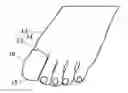 Fig. 01 - Protective toe sleeve for use during aquatic activity