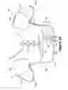 Fig. 35 - Apparel incorporating a protective element