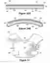 Fig. 37 - Apparel incorporating a protective element
