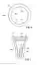 Fig. 04 - RING HAVING A RIGID STRUCTURE BUT HAVING A HOLE OF VARIABLE DIAMETER