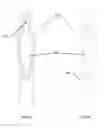 Fig. 11 - Molded Cosmetic Applicators With Perforated Bristles And Mold Therefor