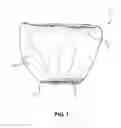 Fig. 02 - Flower Pot Cover