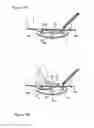 Fig. 10 - WIPE DISPENSER