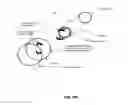 Fig. 48 - Insert imaging device for surgical procedures