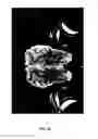 Fig. 56 - Insert imaging device for surgical procedures