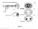 Fig. 92 - Insert imaging device for surgical procedures