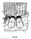 Fig. 03 - SYSTEM INCLUDING GUIDEWIRE FOR DETECTING FLUID PRESSURE