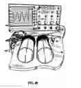 Fig. 04 - SYSTEM INCLUDING GUIDEWIRE FOR DETECTING FLUID PRESSURE