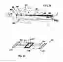 Fig. 12 - SYSTEM INCLUDING GUIDEWIRE FOR DETECTING FLUID PRESSURE