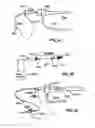 Fig. 19 - SYSTEM INCLUDING GUIDEWIRE FOR DETECTING FLUID PRESSURE