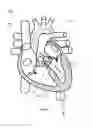 Fig. 10 - Apparatus, system and methods for measuring a blood pressure gradient