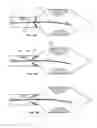 Fig. 16 - Apparatus, system and methods for measuring a blood pressure gradient