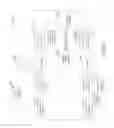 Fig. 24 - Detecting fiducial points in physiological signals