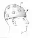 Fig. 01 - ELECTRODE ASSEMBLIES AND ELECTROENCEPHALOGRAPHS DEVICES