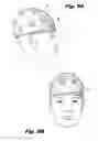 Fig. 04 - ELECTRODE ASSEMBLIES AND ELECTROENCEPHALOGRAPHS DEVICES