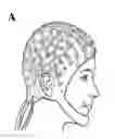 Fig. 01 - BRAIN STATE DEPENDENT THERAPY FOR IMPROVED NEURAL TRAINING AND REHABILITATION