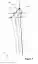 Fig. 02 - METHOD AND APPARATUS FOR DETERMINING A LEG LENGTH DIFFERENCE AND A LEG OFFSET