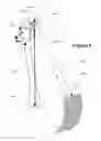 Fig. 07 - METHOD AND APPARATUS FOR DETERMINING A LEG LENGTH DIFFERENCE AND A LEG OFFSET