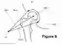 Fig. 08 - METHOD AND APPARATUS FOR DETERMINING A LEG LENGTH DIFFERENCE AND A LEG OFFSET
