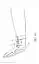 Fig. 06 - Electronic splint