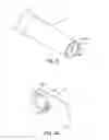 Fig. 03 - Multi lumen catheter