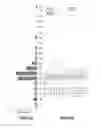 Fig. 03 - System and method for assessing impulse control disorder